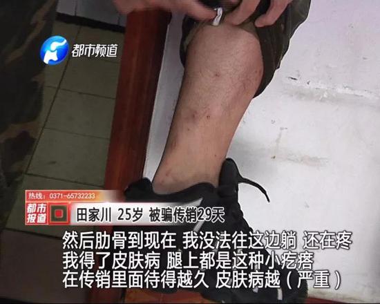 【传销的套路 大家一定要注意，河南三位90后痛诉传销被骗经历】女化妆师被解救 河南三位90后痛诉传销被骗经历(图12)
